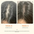 Hair Growth Serum with Built-In Brush