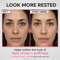 Under-Eye Red Light Beauty Device – Gentle LED Eye Care for Tired-Looking Eyes