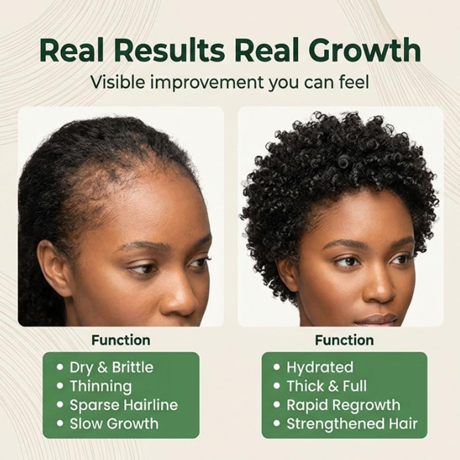 Batana Natural Hair Growth Oil,100% Pure Organic Batana,Prevents Loss for Men & Women