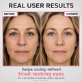 Under-Eye Red Light Beauty Device – Gentle LED Eye Care for Tired-Looking Eyes