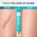Scar Repair Cream