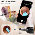 Smart Ear Care Camera Kit
