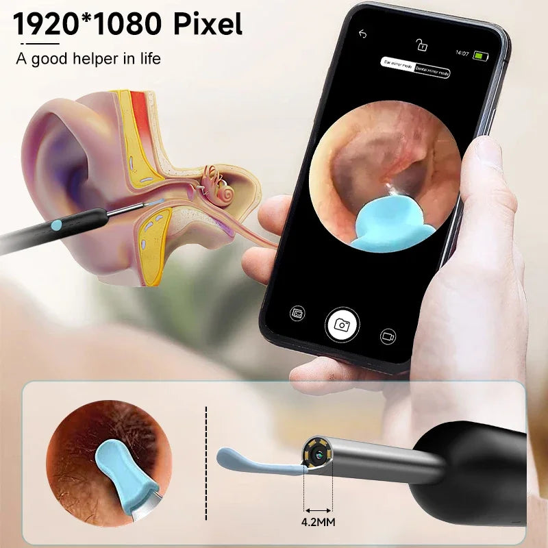 Smart Ear Care Camera Kit