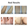 SmoothSkin Glow Hair Remover