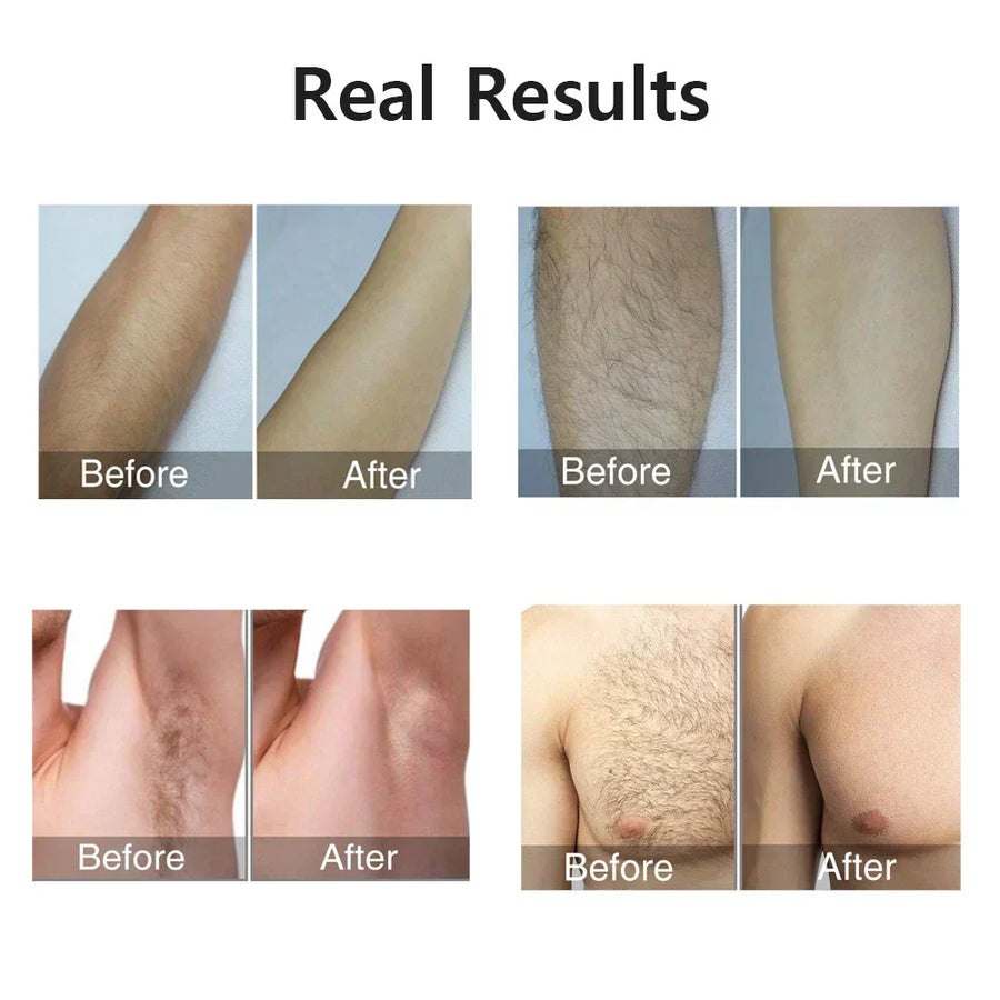 SmoothSkin Glow Hair Remover