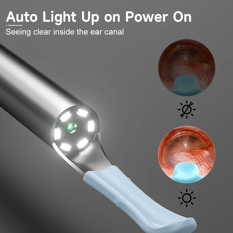Smart Ear Care Camera Kit