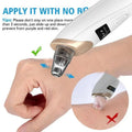 Rechargeable Electric Blackhead Remover, 3-Level Suction, Facial Care Tool